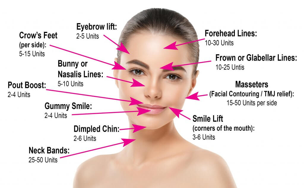 Botox Injection Sites What Facial Areas Can Be Treated With Botox?