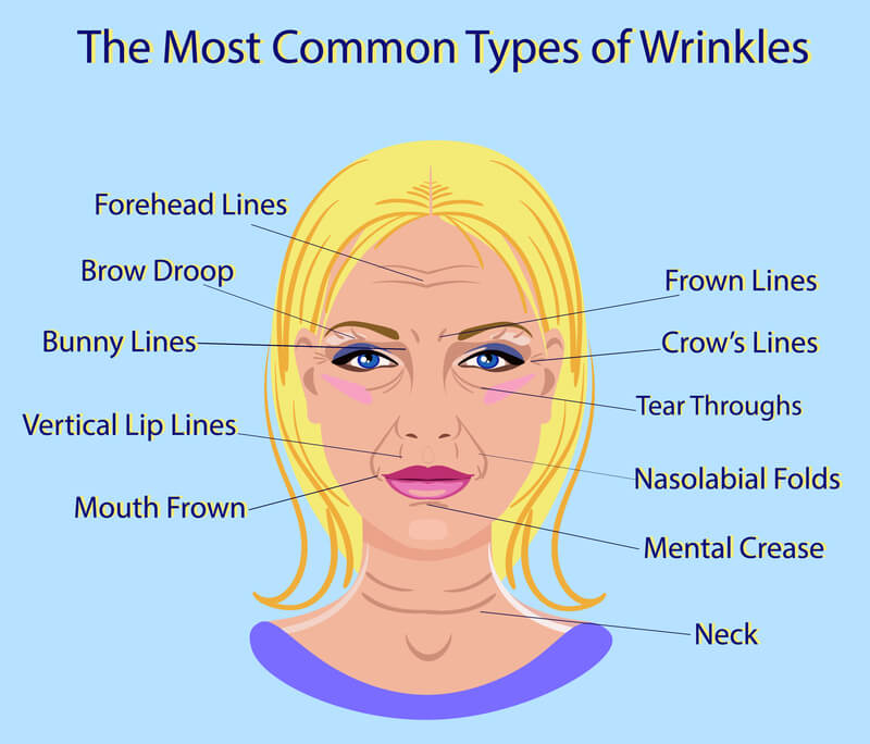 Common Types of Facial Wrinkles (Rhytides) - Westlake Dermatology