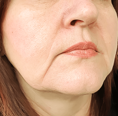 How to avoid wrinkles - No wrinkles at 40! 3 simple things I do to